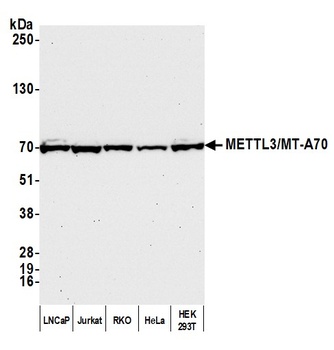 Rabbit anti-METTL3/MT-A70 Antibody
