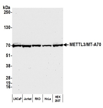 METTL3/MT-A70 Antibody