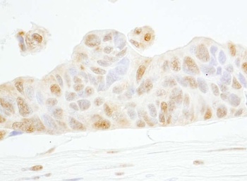Rabbit Cyclin E1 Antibody