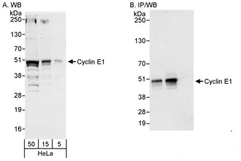 Rabbit Cyclin E1 Antibody