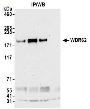 WDR62 Antibody