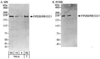 FIP200/RB1CC1 Antibody
