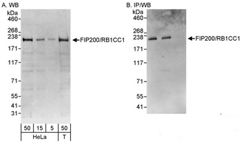 Rabbit anti-FIP200/RB1CC1 Antibody
