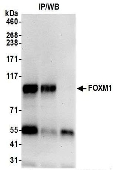 FOXM1 Antibody