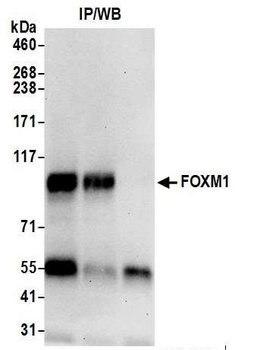 Rabbit anti-FOXM1 Antibody