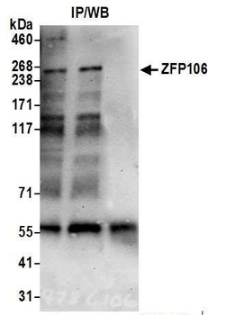 ZFP106 Antibody