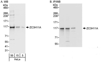 Rabbit anti-ZC3H11A Antibody