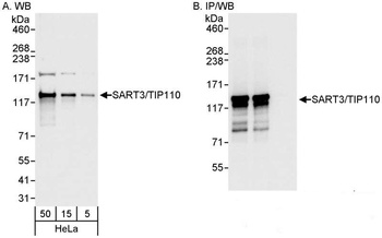 Rabbit anti-SART3/TIP110 Antibody