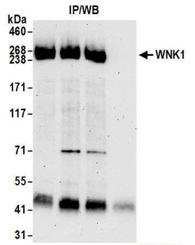 Rabbit anti-WNK1 Antibody
