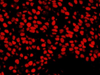 Rabbit anti-NUMA Antibody