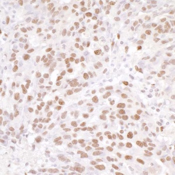 Rabbit NUCKS Antibody