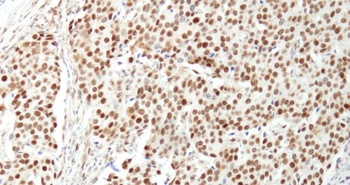 Rabbit NUCKS Antibody
