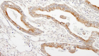 Rabbit anti-MAP7 Antibody