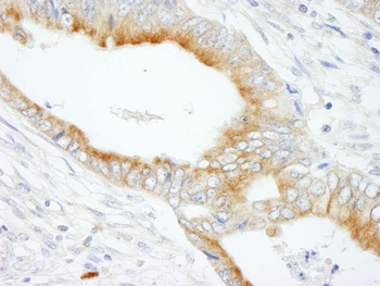 Rabbit anti-MAP7 Antibody