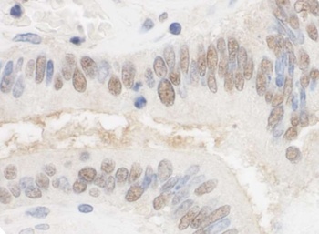 Rabbit anti-CSTF2T/TauCSTF64 Antibody