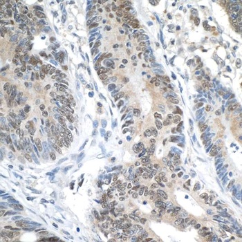 Rabbit anti-ERCC5/XPG Antibody