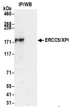 Rabbit anti-ERCC5/XPG Antibody