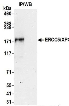 ERCC5/XPG Antibody