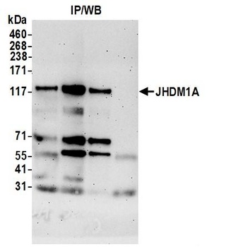 JHDM1A Antibody