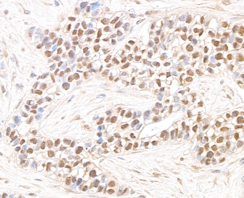 Rabbit anti-JHDM1A Antibody