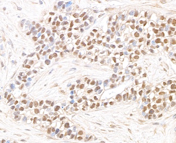 JHDM1A Antibody