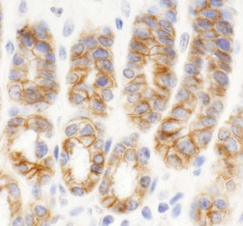 Rabbit anti-KIAA0528 Antibody