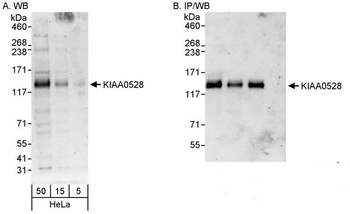 KIAA0528 Antibody