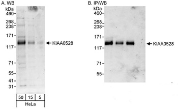 Rabbit anti-KIAA0528 Antibody
