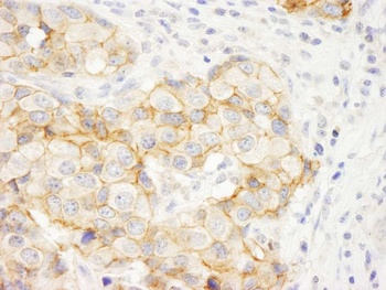Rabbit anti-KIAA0528 Antibody