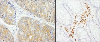 Rabbit PABP4 Antibody