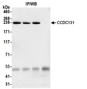 CCDC131 Antibody