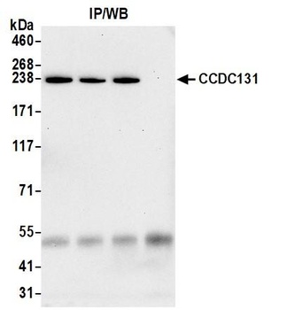 Rabbit anti-CCDC131 Antibody