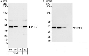 Rabbit anti-PHF6 Antibody