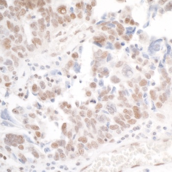 Rabbit anti-PHF6 Antibody