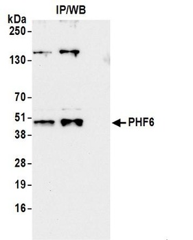 Rabbit anti-PHF6 Antibody