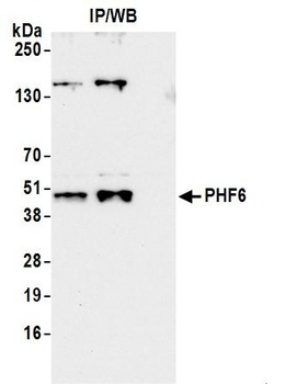 PHF6 Antibody