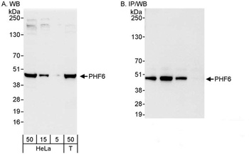 Rabbit anti-PHF6 Antibody
