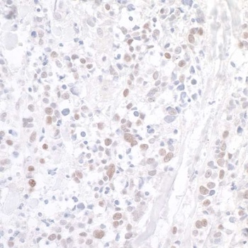 Rabbit anti-WDR79 Antibody