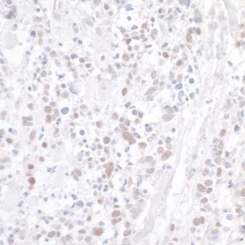 WDR79 Antibody