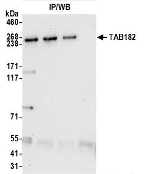 TAB182 Antibody