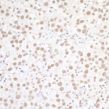Rabbit anti-WTAP Antibody