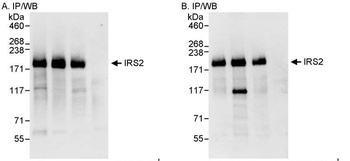 Rabbit anti-IRS2 Antibody