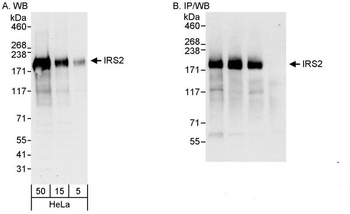 Rabbit IRS2 Antibody
