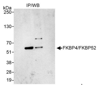 Rabbit anti-FKBP4/FKBP52 Antibody