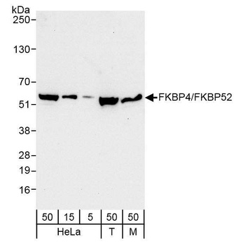 Rabbit anti-FKBP4/FKBP52 Antibody