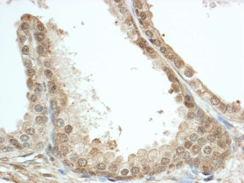 Rabbit anti-FKBP4/FKBP52 Antibody