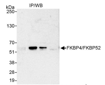 Rabbit anti-FKBP4/FKBP52 Antibody