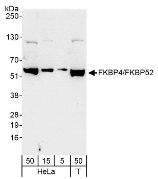 Rabbit anti-FKBP4/FKBP52 Antibody
