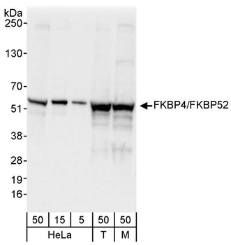 Rabbit anti-FKBP4/FKBP52 Antibody