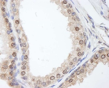 Rabbit anti-FKBP4/FKBP52 Antibody